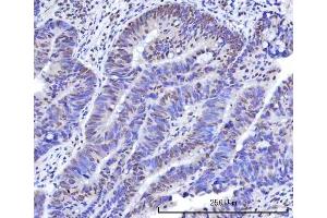 IHC analysis of RBM15B using anti-RBM15B antibody (ABIN7600219).