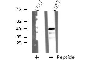 Western blot analysis of extracts from COS7 cells, using TSSC1 antibody. (TSSC1 Antikörper)
