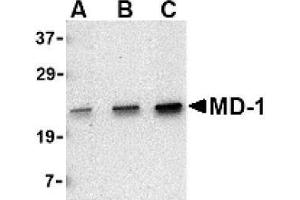 Image no. 1 for anti-Lymphocyte Antigen 86 (LY86) (C-Term) antibody (ABIN265131) (LY86 Antikörper  (C-Term))