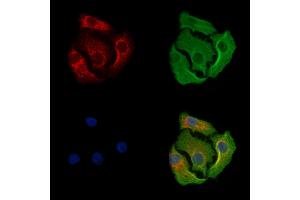 MARK3 Antibody staining Hela cells by IF/ICC.
