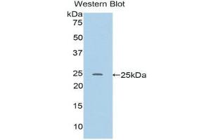 Western Blotting (WB) image for anti-RalA Binding Protein 1 (RALBP1) (AA 192-380) antibody (ABIN1176607)