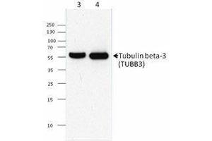 Western Blotting (WB) image for anti-Tubulin, beta 3 (TUBB3) antibody (ABIN2665448) (TUBB3 Antikörper)