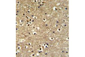 Formalin fixed and paraffin embedded brain tissue reacted with ETS2 Antibody (Center) followed by peroxidase conjugation of the secondary antibody and DAB staining. (ETS2 Antikörper  (Middle Region))