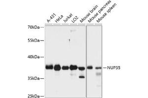 Western blot analysis of extracts of various cell lines, using NUP35 antibody (ABIN6129527, ABIN6144960, ABIN6144961 and ABIN6216505) at 1:3000 dilution. (NUP35 Antikörper  (AA 1-326))