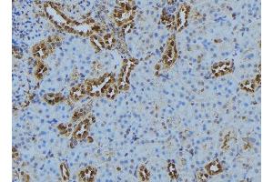 ABIN6278096 at 1/100 staining Mouse kidney tissue by IHC-P. (CASQ2 Antikörper)