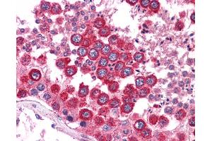 Immunohistochemistry (IHC) image for anti-Wingless-Type MMTV Integration Site Family, Member 2B (WNT2B) (N-Term) antibody (ABIN6745721)