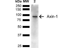 Western blot analysis of Rat Kidney showing detection of ~95 kDa Axin-1 protein using Rabbit Anti-Axin-1 Polyclonal Antibody (ABIN5667588). (Axin Antikörper  (AA 470-570) (Alkaline Phosphatase (AP)))