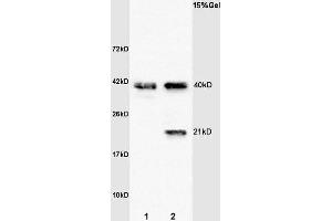 L1 rat brain lysates L2 human colon carcinoma lysates probed with Anti- Syndecan 4 Polyclonal Antibody, Unconjugated (ABIN681793) at 1:200 overnight at 4 °C. (SDC4 Antikörper  (AA 101-198))