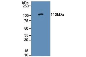 Detection of PTPRN in Rat Adrenal Gland Tissue using Polyclonal Antibody to Protein Tyrosine Phosphatase Receptor Type N (PTPRN) (PTPRN Antikörper  (AA 368-575))