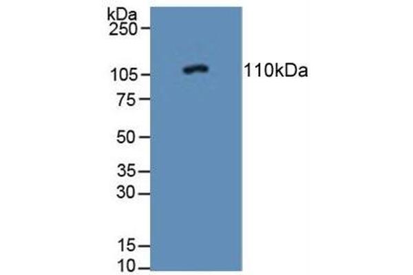 PTPRN Antikörper  (AA 368-575)