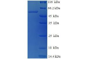 SDS-PAGE (SDS) image for Tyrosinase (TYR) (AA 19-377), (partial) protein (His-SUMO Tag) (ABIN5710578)