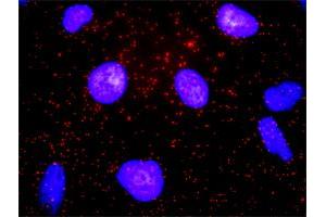 Proximity Ligation Analysis of protein-protein interactions between CD19 and CD82. (CD19 Antikörper  (AA 1-556))