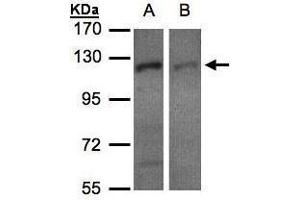 WB Image Sample(30 μg of whole cell lysate) A:H1299 B:HeLa S3, 7. (Exportin 7 Antikörper  (C-Term))