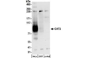 Western Blotting (WB) image for anti-G Protein-Coupled Receptor Kinase Interactor 2 (GIT2) (AA 608-658) antibody (ABIN7450977)