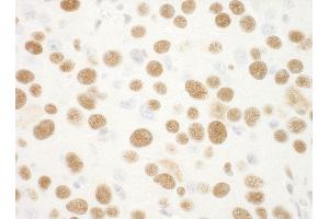 Immunohistochemistry (IHC) image for anti-Nucleophosmin (Nucleolar phosphoprotein B23, Numatrin) (NPM1) (AA 250-294) antibody (ABIN7448992)