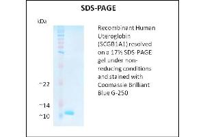 SDS-PAGE (SDS) image for Secretoglobin, Family 1A, Member 1 (Uteroglobin) (SCGB1A1) (Active) protein (ABIN5509511) (SCGB1A1 Protein)