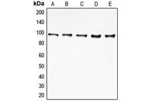 Western blot analysis of EIF4G2 expression in MCF7 (A), HeLa (B), K562 (C), Jurkat (D), HepG2 (E) whole cell lysates.