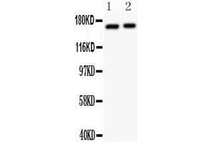Anti-NMDAR2A antibody,  Western blotting All lanes: Anti NMDAR2A () at 0.