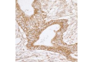 Immunohistochemistry (IHC) image for anti-TNF Receptor-Associated Protein 1 (TRAP1) (AA 50-100) antibody (ABIN7455062) (TRAP1 Antikörper  (AA 50-100))