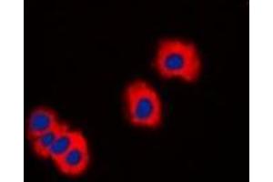Immunofluorescent analysis of IRAK3 staining in LOVO cells.