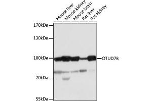 Western blot analysis of extracts of various cell lines, using OTUD7B antibody (ABIN7269125) at 1:1000 dilution. (OTUD7B Antikörper  (AA 530-700))
