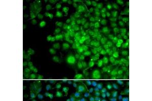 Immunofluorescence analysis of HeLa cells using FHL1 Polyclonal Antibody (FHL1 Antikörper)