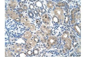 FBXO25 antibody was used for immunohistochemistry at a concentration of 4-8 ug/ml to stain Epithelial cells of renal tubule (arrows) in Human Kidney.