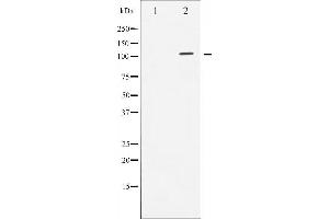 Western blot analysis of Androgen Receptor expression in LOVO whole cell lysates,The lane on the left is treated with the antigen-specific peptide. (Androgen Receptor Antikörper)
