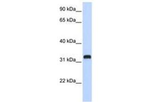 Image no. 1 for anti-Chromosome 21 Open Reading Frame 62 (C21orf62) (AA 108-157) antibody (ABIN6740939) (C21orf62 Antikörper  (AA 108-157))