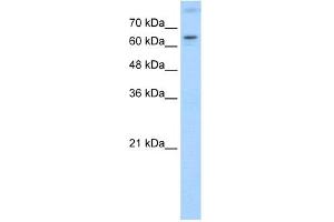 WB Suggested Anti-RORA Antibody Titration:  1. (RORA Antikörper  (N-Term))