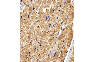 Immunohistochemistry (Paraffin-embedded Sections) (IHC (p)) image for anti-Fatty Acid Binding Protein 3, Muscle and Heart (FABP3) (AA 1-133) antibody (ABIN6242886)