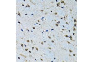 Immunohistochemistry of paraffin-embedded rat brain using IGF1 antibody (ABIN1873156) at dilution of 1:100 (40x lens). (IGF1 Antikörper)