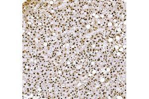 IHC analysis of Histone H1.