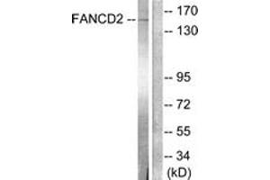Western blot analysis of extracts from HT-29 cells, treated with Calyculin A 50ng/ml 30', using FANCD2 (Ab-222) Antibody.