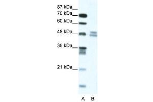 WB Suggested Anti-TRIP13  Antibody Titration: 5. (TRIP13 Antikörper  (N-Term))
