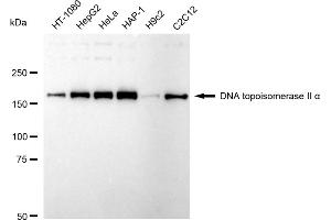 Western blotting analysis using DNA topoisomerase II alpha antibody (ABIN7800574). (Rekombinanter Topoisomerase II alpha Antikörper)