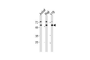 ACHE Antibody (N-term) (ABIN392325 and ABIN2841973) western blot analysis in Jurkat,Raji,Y79 cell line lysates (35 μg/lane). (Acetylcholinesterase Antikörper  (N-Term))
