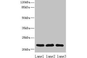 Western blot All lanes: SSR3 antibody at 10 μg/mL Lane 1: Hela whole cell lysate Lane 2: U87 whole cell lysate Lane 3: A431 whole cell lysate Secondary Goat polyclonal to rabbit IgG at 1/10000 dilution Predicted band size: 22, 23 kDa Observed band size: 22 kDa