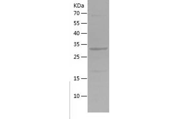 NOS1 Protein (AA 101-301) (His tag)