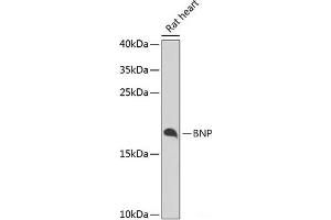 Western blot analysis of extracts of Rat heart using BNP Polyclonal Antibody at dilution of 1:1000. (BNP Antikörper)