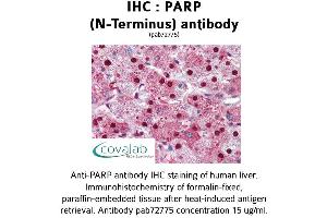 Image no. 1 for anti-Poly (ADP-Ribose) Polymerase 1 (PARP1) (N-Term) antibody (ABIN2852390) (PARP1 Antikörper  (N-Term))