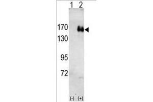 Western blot analysis of HER2(arrow) using rabbit polyclonal HER2 antibody. (ErbB2/Her2 Antikörper)