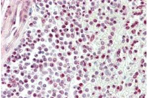 Human Spleen: Formalin-Fixed, Paraffin-Embedded (FFPE)