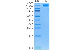 Oncostatin M Receptor Protein (OSMR) (AA 28-737) (His tag)