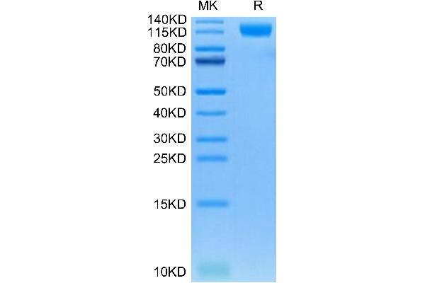 Oncostatin M Receptor Protein (OSMR) (AA 28-737) (His tag)