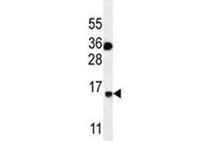 S100A1 antibody western blot analysis in MDA-MB435 lysate. (S100A1 Antikörper  (AA 45-75))