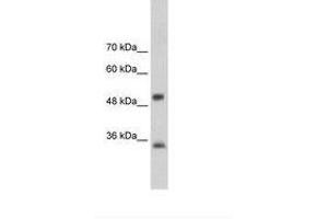 Image no. 2 for anti-Aryl Hydrocarbon Receptor Interacting Protein (AIP) (AA 101-150) antibody (ABIN202262) (AIP Antikörper  (AA 101-150))