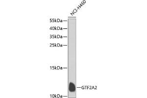 Western blot analysis of extracts of NCI-H460 cells, using GTF2 antibody  at 1:1000 dilution. (GTF2A2 Antikörper  (AA 1-109))