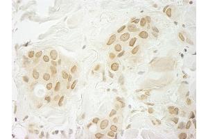 Immunohistochemistry (IHC) image for anti-Makorin Ring Finger Protein 1 (MKRN1) (C-Term) antibody (ABIN7448670)