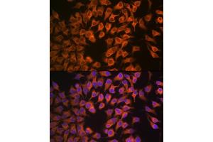 Immunofluorescence analysis of HeLa cells using CYP17 Rabbit mAb (ABIN7266648) at dilution of 1:100 (40x lens). (CYP17A1 Antikörper)